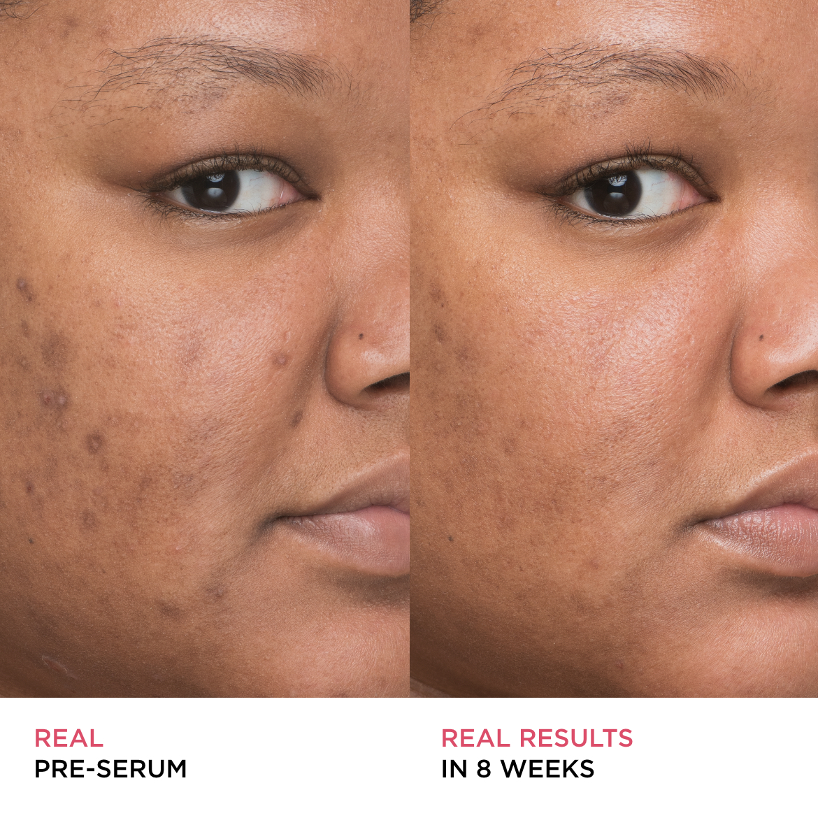 Bye Bye Dark Spots 4 Niacinamide Serum IT Cosmetics